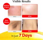 EQQUALBERRY Vitamin Illuminating Serum 30 ml – Vitamin C & Niacinamide Face Serum with Arbutin, Ceramides & Hyaluronic Acid, Hydrating Radiance-Support - Image 4