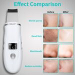 Skin Scrubber Face Spatula - 4-in-1 Deep Cleansing Tool for Pore Extraction, Fast Charging Dock Blackhead Remover Face Spatula for Facial Skincare Women Gift (White) - Image 4