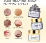 ANAI RUI 3PCS Clay Mask Set - Dead Sea Mud, Turmeric & Green Tea Face Mask for Acne, Blackheads & Dark Spots - Brightening Spa Gift Set for Women & Men - Pore Cleansing & Oil Control (3x70g) - Image 6